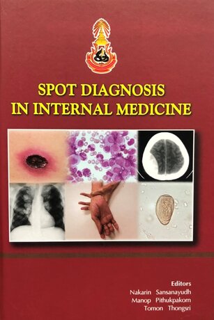 SPOT DIAGNOSIS IN INTERNAL MEDICINE