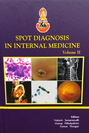 SPOT DIAGNOSIS IN INTERNAL MEDICINE VOLUME II