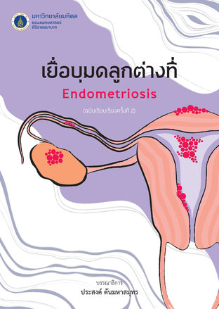 เยื่อบุมดลูกต่างที่ (ฉบับเรียบเรียงครั้งที่ 2) Endometriosis