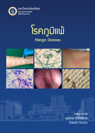 โรคภูมิแพ้ Allergic Diseases