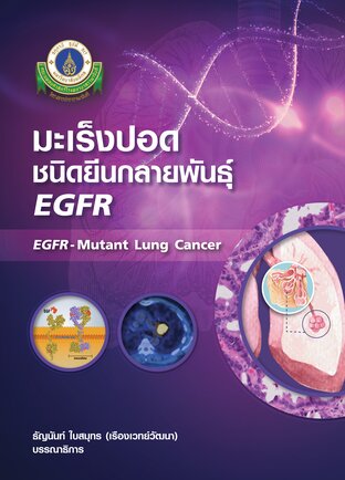 มะเร็งปอดชนิดยีนกลายพันธุ์ EGFR (EGFR – Mutant Lung Cancer)