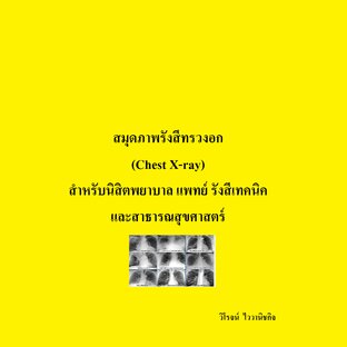 สมุดภาพรังสีทรวงอก (Chest X-ray) สำหรับนิสิตพยาบาล แพทย์ รังสีเทคนิคและสาธารณสุขศาสตร์