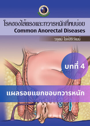 โรคของไส้ตรงและทวารหนักที่พบบ่อย บทที่ 4 แผลรอยแยกขอบทวารหนัก