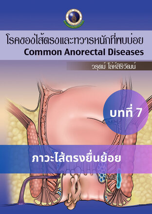 โรคของไส้ตรงและทวารหนักที่พบบ่อย บทที่ 7 ภาวะไส้ตรงยื่นย้อย