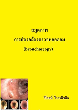 สมุดภาพการส่องกล้องตรวจหลอดลม (bronchoscopy)