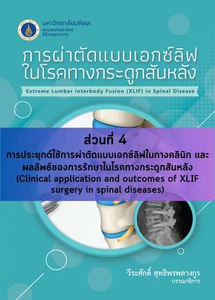 การผ่าตัดแบบเอกซ์ลิฟในโรคทางกระดูกสันหลัง ส่วนที่ 4