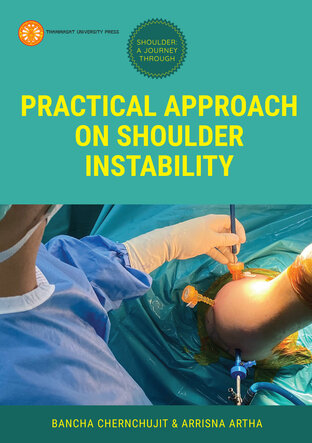 Practical Approach on Shoulder Instability