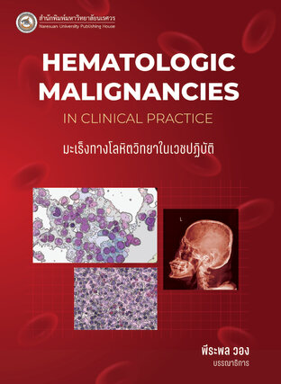 มะเร็งทางโลหิตวิทยาในเวชปฏิบัติ Hematologic Malignancies in Clinical Practice