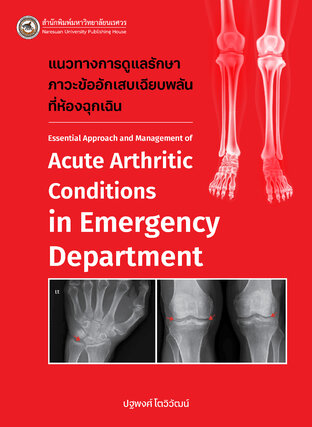 แนวทางการดูแลรักษาภาวะข้ออักเสบเฉียบพลันที่ห้องฉุกเฉิน