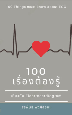 100 เรื่องต้องรู้ เกี่ยวกับ Electrocardiogram