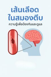 เส้นเลือดในสมองตีบ
