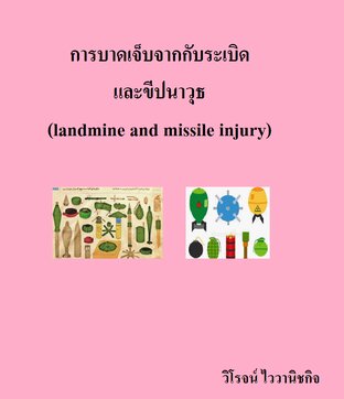 การบาดเจ็บจากกับระเบิด และขีปนาวุธ  (landmine and missile injury)