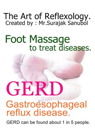 Gastroesophageal reflux disease. (GERD)