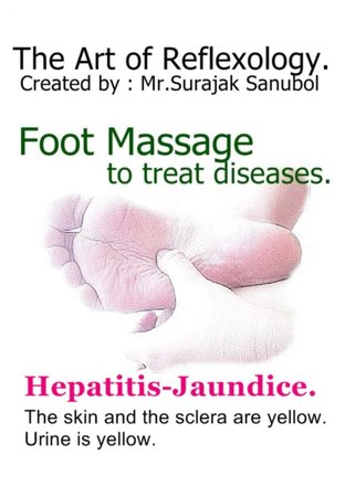 Hepatitis-Jaundice