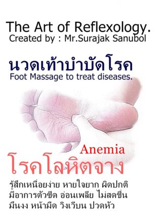 โรคโลหิตจาง