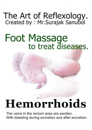 Hemorrhoids