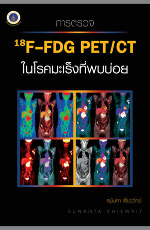 การตรวจ 18FDG PETCT ในโรคมะเร็งที่พบบ่อย
