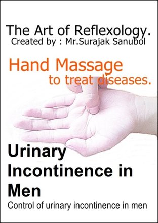 Control of urinary incontinence in men.