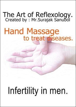 Infertility in men