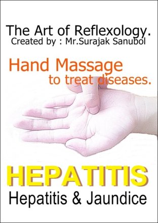 Hepatitis Jaundice